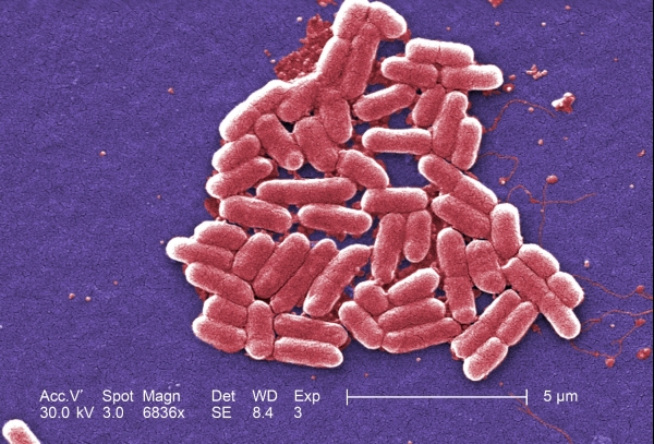 Enterohämorrhagische Escherichia coli,  Text: dts Nachrichtenagentur